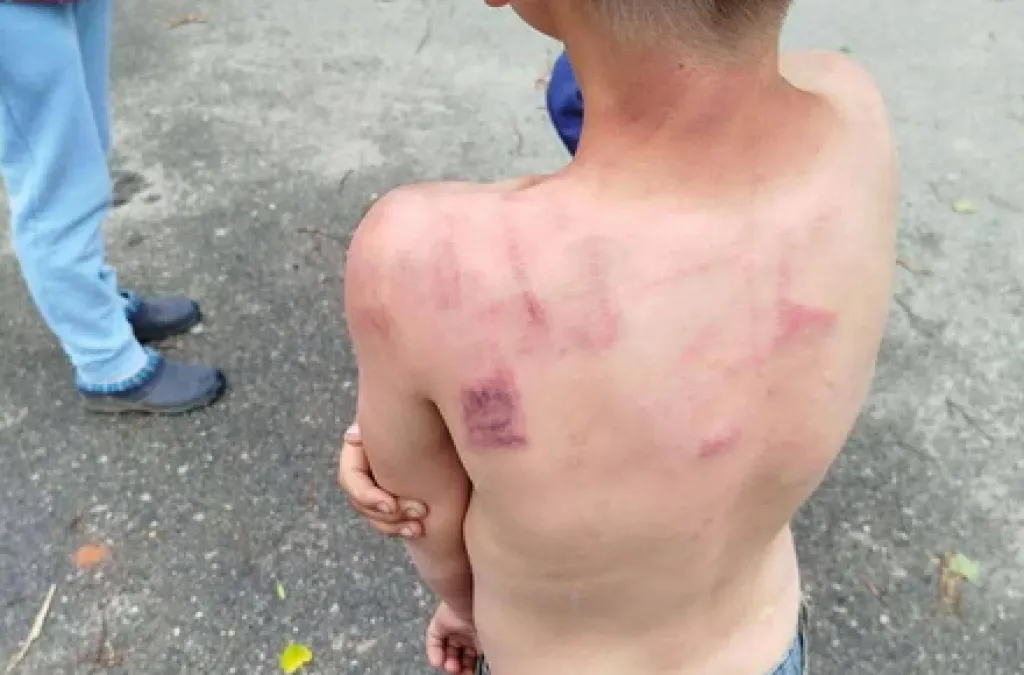 У Радомишльській громаді перевірили повідомлення про насильство в родині з дітьми