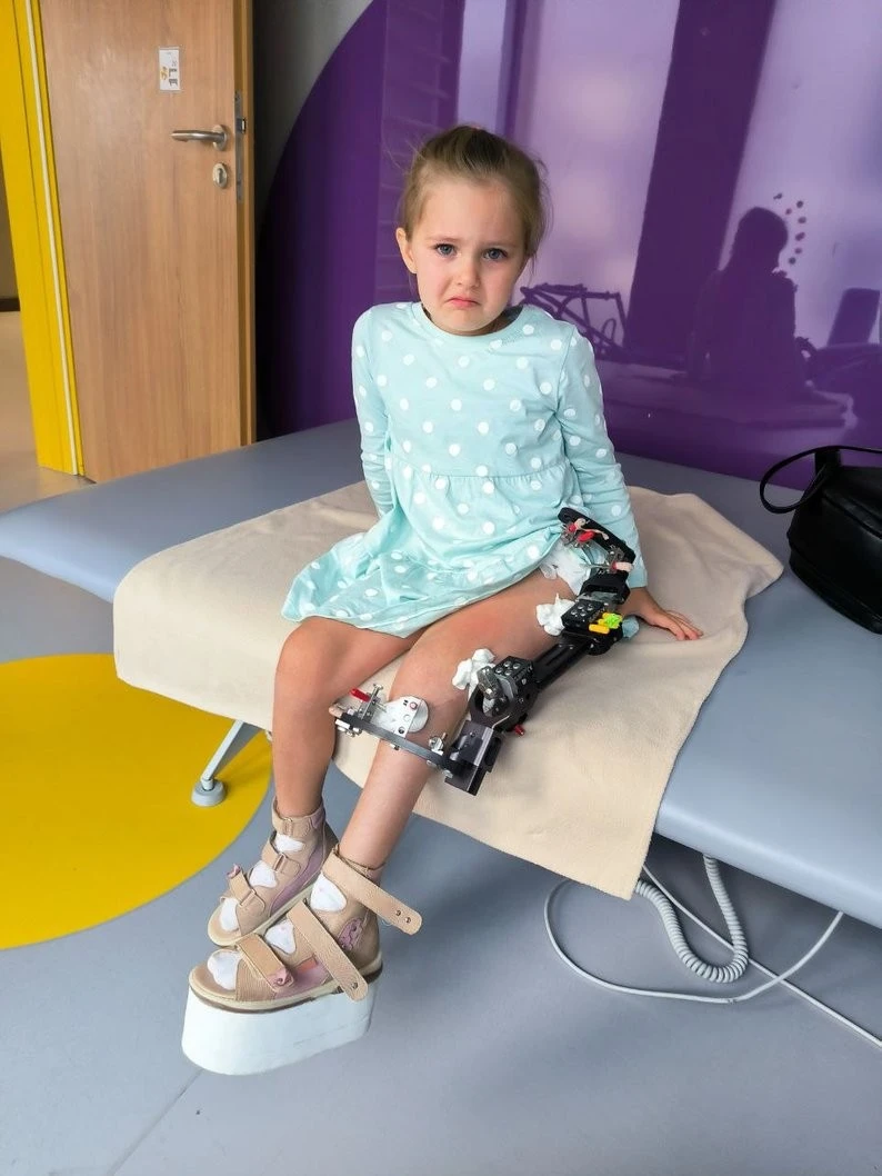Дарині Плисковській з Бердичева потрібна допомога на лікування рідкісної патології ноги