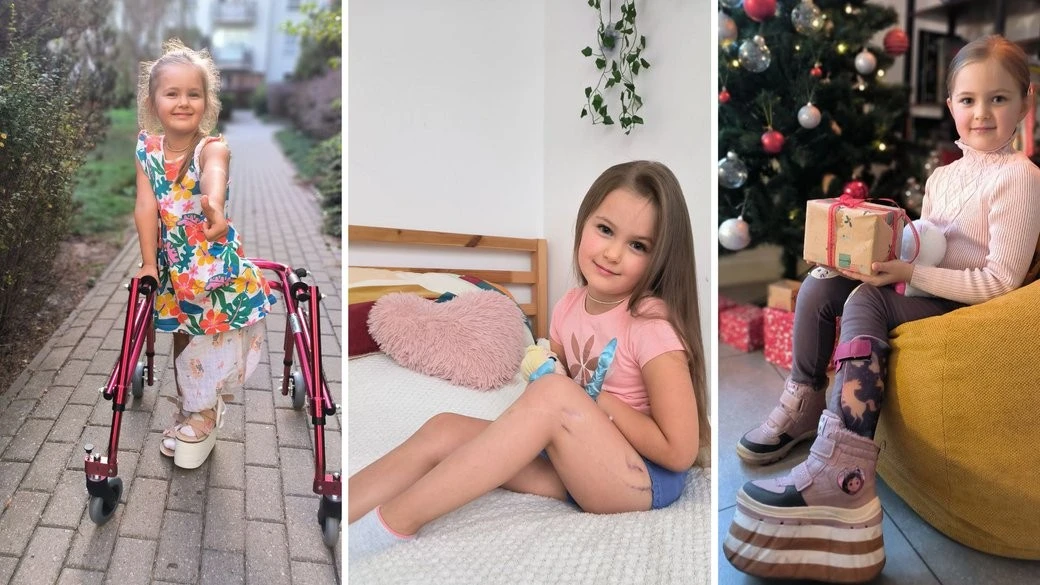 Дарині Плисковській з Бердичева потрібна допомога на лікування рідкісної патології ноги