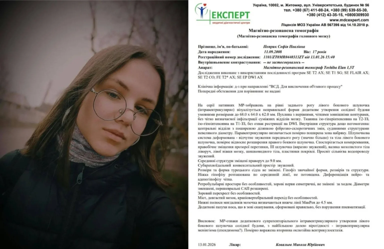 У Житомирі збирають кошти на лікування 17-річної студентки з критичною пухлиною мозку