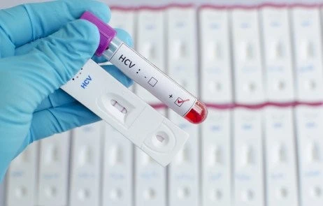 МОЗ закликає громадян пройти безкоштовне тестування на гепатити у сімейних лікарів